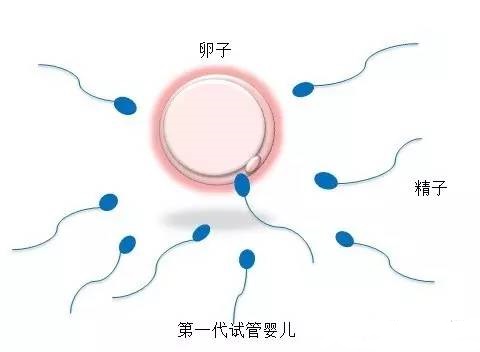 时差培养箱
